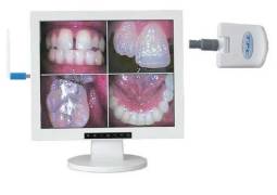 Monitors With Intraoral Cameras  - TPC