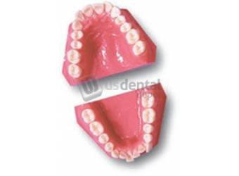 ECCO - Orthodontic 1999-1 Class II Div I Sub Div Left - Practice Model -