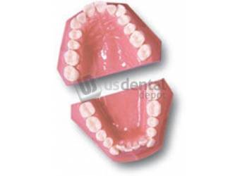 ECCO - Orthodontic 2061-1 Class II Deep Bite - Practice Model -