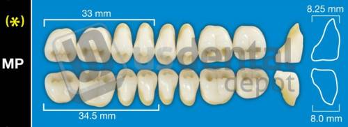 DAVINCI MP5 Lower Posteriors A0 (1 X 6)  Davinci 4 layers Denture Acrylic Teeth - Cross linked & Fluorescent with great abrasion resistance