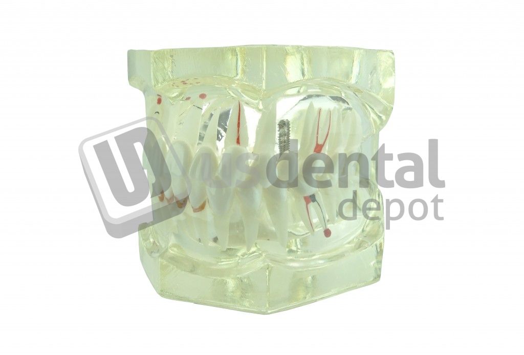 867 ARTICULATED NORMAL TEETH COLUMBUS GRANDE US Dental