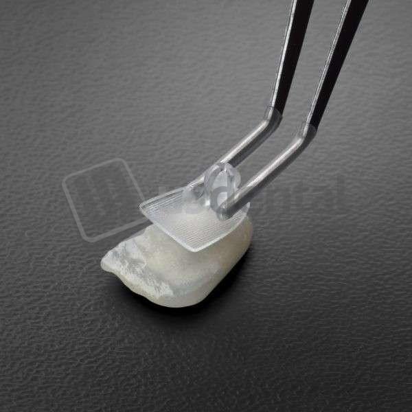 MY SHADE GUIDE, CLIPS, 100PCS SMILE LINE 7525 US Dental Depot