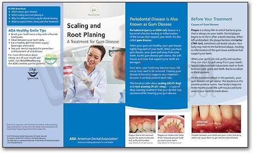 ADA BROCHURE: SCALING AND ROOT PLAN | SMART # BR5986 | US Dental Depot