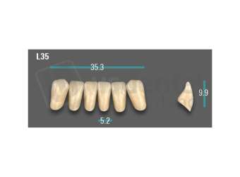 VITA - VIONIC EXCELL DD FRAME Anterior, A1, L35 - Teeth - Vionic Frames - # AGA1L35
