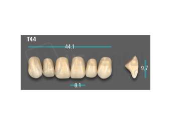 VITA - VIONIC EXCELL DD FRAME Anterior, A1, T44 - Teeth - Vionic Frames - # AGA1T44