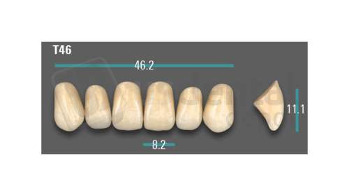 VITA - VIONIC EXCELL DD FRAME Anterior, A1, T46 - Teeth - Vionic Frames - # AGA1T46