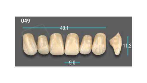 VITA - VIONIC EXCELL DD FRAME Anterior, A2, O49 - Teeth - Vionic Frames - # AGA2O49