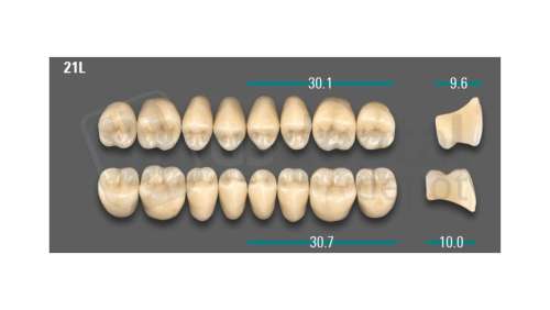 VITA - VIONIC LINGOFORM DD FRAME Posterior, A3, 21L UK                      - Teeth - Vionic Frames - # AGA321LU