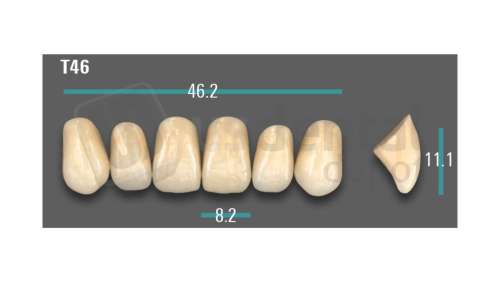VITA - VIONIC EXCELL DD FRAME Anterior, A3.5, T46 - Teeth - Vionic Frames - # AGA35T46