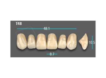 VITA - VIONIC EXCELL DD FRAME Anterior, A3.5, T48 - Teeth - Vionic Frames - # AGA35T48