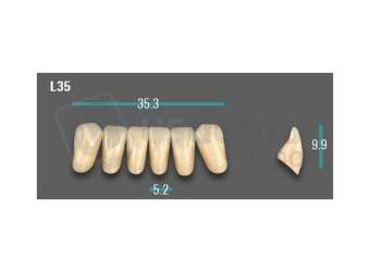 VITA - VIONIC EXCELL DD FRAME Anterior, B3, L35 - Teeth - Vionic Frames - # AGB3L35