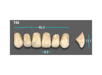 VITA - VIONIC EXCELL DD FRAME Anterior, B3, T46 - Teeth - Vionic Frames - # AGB3T46