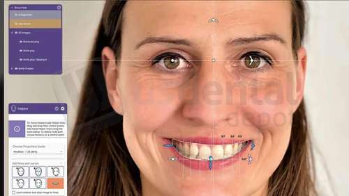 EXOCAD - Smile Creator Module. Perpetual License Upgrade Contract, per year from year two. exocad dental CAD software license, delivered electronically, no physical shipment. USDD item 701009P-Y2. - # 701009P-Y2