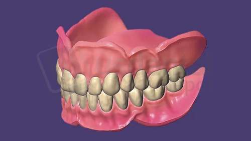 EXOCAD - FullDenture Module including Ivotion. Perpetual License including the first year of software upgrades. exocad dental CAD software license, delivered electronically, no physical shipment. USDD item 701010P-Y1. - # 701010P-Y1