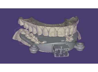 EXOCAD - Jaw Motion Import Module. Flex Annual plan initial fee for year one. exocad dental CAD software license, delivered electronically, no physical shipment. USDD item 701015F-Y1. - # 701015F-Y1