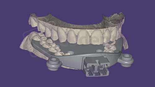 EXOCAD - Jaw Motion Import Module. Flex Annual plan yearly renewal fee from year two. exocad dental CAD software license, delivered electronically, no physical shipment. USDD item 701015F-Y2. - # 701015F-Y2