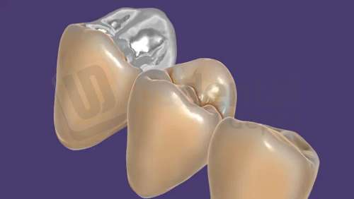 EXOCAD - TruSmile Module. Flex Annual plan yearly renewal fee from year two. exocad dental CAD software license, delivered electronically, no physical shipment. USDD item 701003F-Y2. - # 701003F-Y2