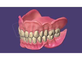 EXOCAD - FullDenture Module including Ivotion for DentalDB. Flex Annual plan yearly renewal fee from year two. exocad dental CAD software license, delivered electronically, no physical shipment. USDD item 701010F-SA-Y2. - # 701010F-SA-Y2