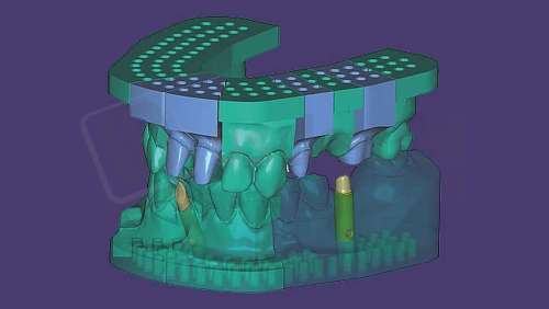 EXOCAD - Model Creator with Implant Analogs for DentalDB. Flex Annual plan yearly renewal fee from year two. exocad dental CAD software license, delivered electronically, no physical shipment. USDD item 701008F+701005F-SA-Y2. - # 701008F+701005F-SA-Y2