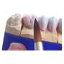 RENFERT -  Ceramicus Brush Size #00 2pcs-#1716-0120 #17160120