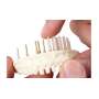 RENFERT -  Pro-Fix Precision pin 100pk-#367-1000 #3671000-Easy-Glide Now also for single-pin users This function which enables pins to be easily removed-is well-proven a thousand times over with the Bi-V-Pins with plastic sleeves. #3671000