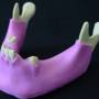 IMPLANTOSS - M-430 ImplantOSS Student Model -Mandible with some teeth and Gum #4012G ( Patient education student models )