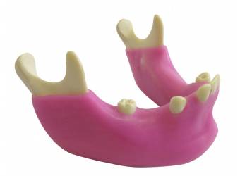 Implant Models ( Practice ) - IMPLANTOSS