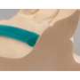 RENFERT -  GEO lingual bars (4x2mm ) 65 g (2.28 oz.)- #6673042