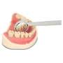 PRACTICON - One-Sided Mirro-Vac 2 Mirror Suction Saliva Ejector   50/Bags # 7042632  ( dis-posable )