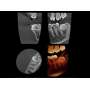 GENORAY PAPAYA 3D LITE 18S 3D PANORAMIC & CBCT  16X8