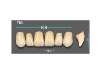 Anterior - A1