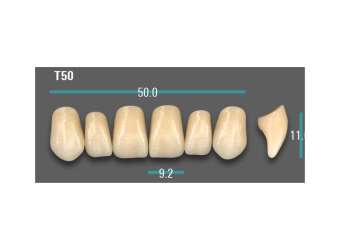 Anterior - A2