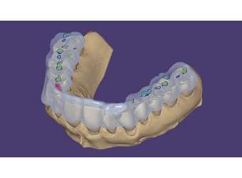 With Articulator DB Flex Y1