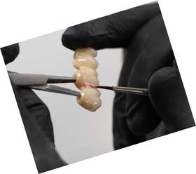 MPF Gingiva Structure Layering Brush Tip - Synthetic 9mm (1/pk) application
