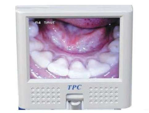 TPC Dental TPC - Camera Mounted LCD Display 2.5in Camera Intraoral Camera