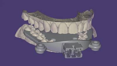 exocad Jaw Motion Import