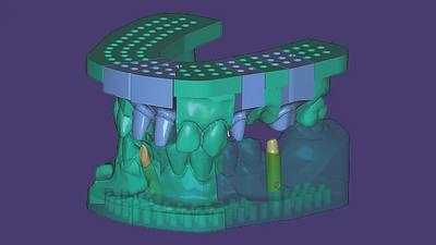 exocad Model Creator