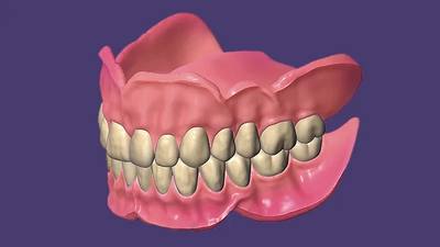 exocad FullDenture