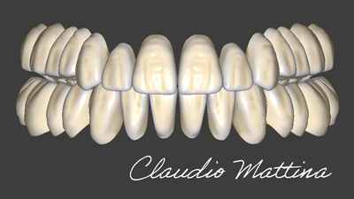 exocad Inspira Tooth Library